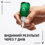 Сыворотка-пилинг Vichy Normaderm Probio-BHA Serum для коррекции недостатков жирной и проблемной кожи лица, 30 мл