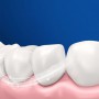 Семейный набор зубных щеток Oral-B Color Collection Средней жесткости, 4 шт