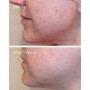 Ежедневный очищающий пилинг для лица Murad Daily Clarifying Peel, 95 мл