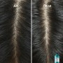 Дерморегулирующий шампунь для волос L'Oreal Professionnel Scalp Advanced Professional Shampoo против перхоти, 300 мл